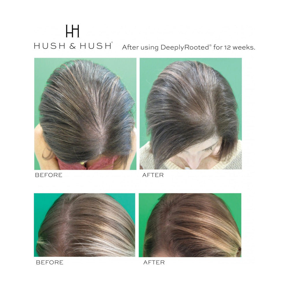 HUSH & HUSH DEEPLY ROOTED 120 CAPS